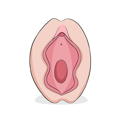 Vulva tipo mariposa