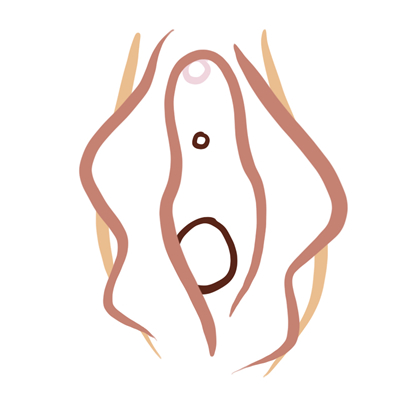 Vulva tipo mariposa Vulva tipo mariposa