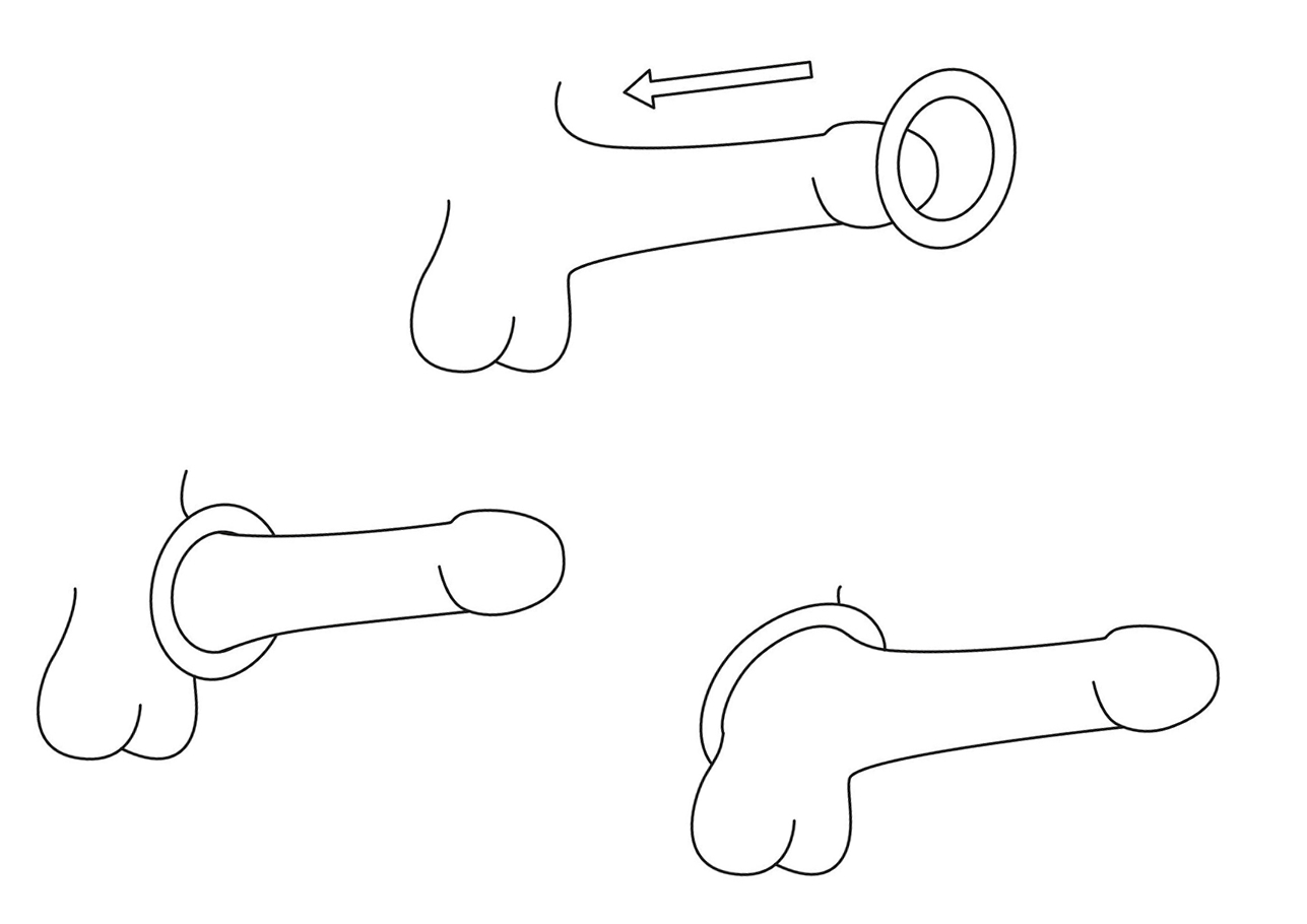 Colocación correcta de los anillos para el pene Colores de todo tipo para los vibradores
