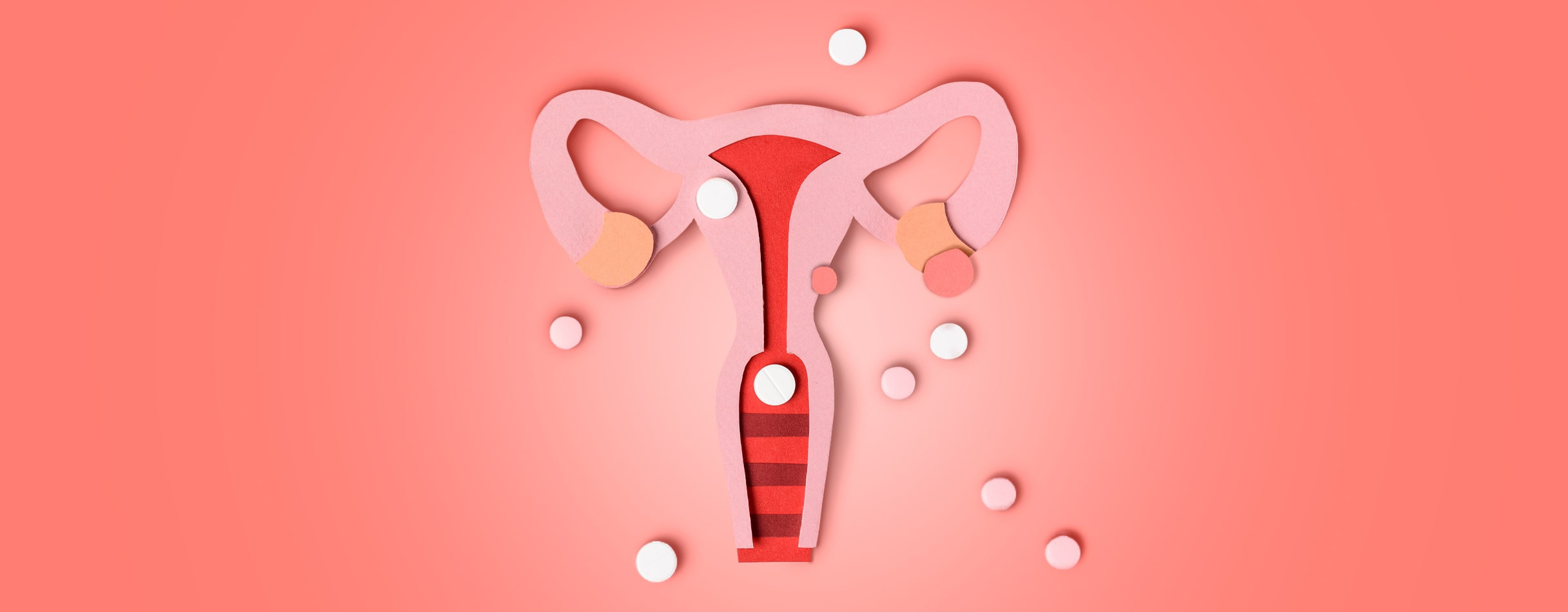 Endometriosis | Síntomas, causas y tratamiento