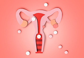 Endometriosis | Síntomas, causas y tratamiento