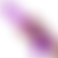Queen Size 30,5 cm Morado