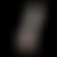 Dildo Model 1 Rosa Fosforescente