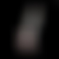 Dildo Model 1 Rosa Fosforescente