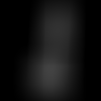 Clear Dildo Realista Transparente 22 cm x 4,6 cm