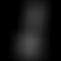 Clear Dildo Realista Transparente 22 cm x 4,6 cm