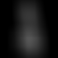 Clear Dildo Realista Transparente 18,5 cm x 3,8 cm