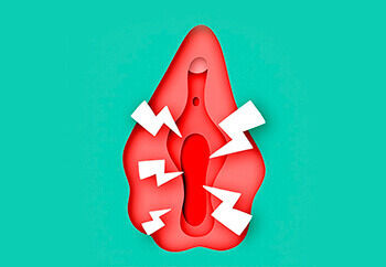 Vaginismo | Cómo repensar el placer